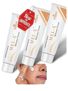 Wheezal Mel X Melasma Cream 25Gm